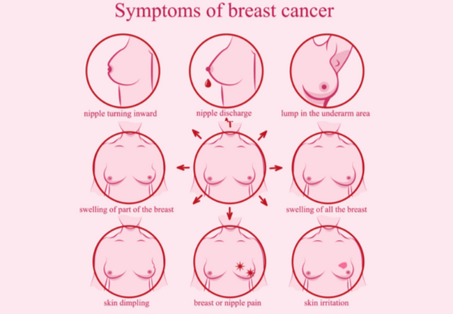 Breast cancer symptoms