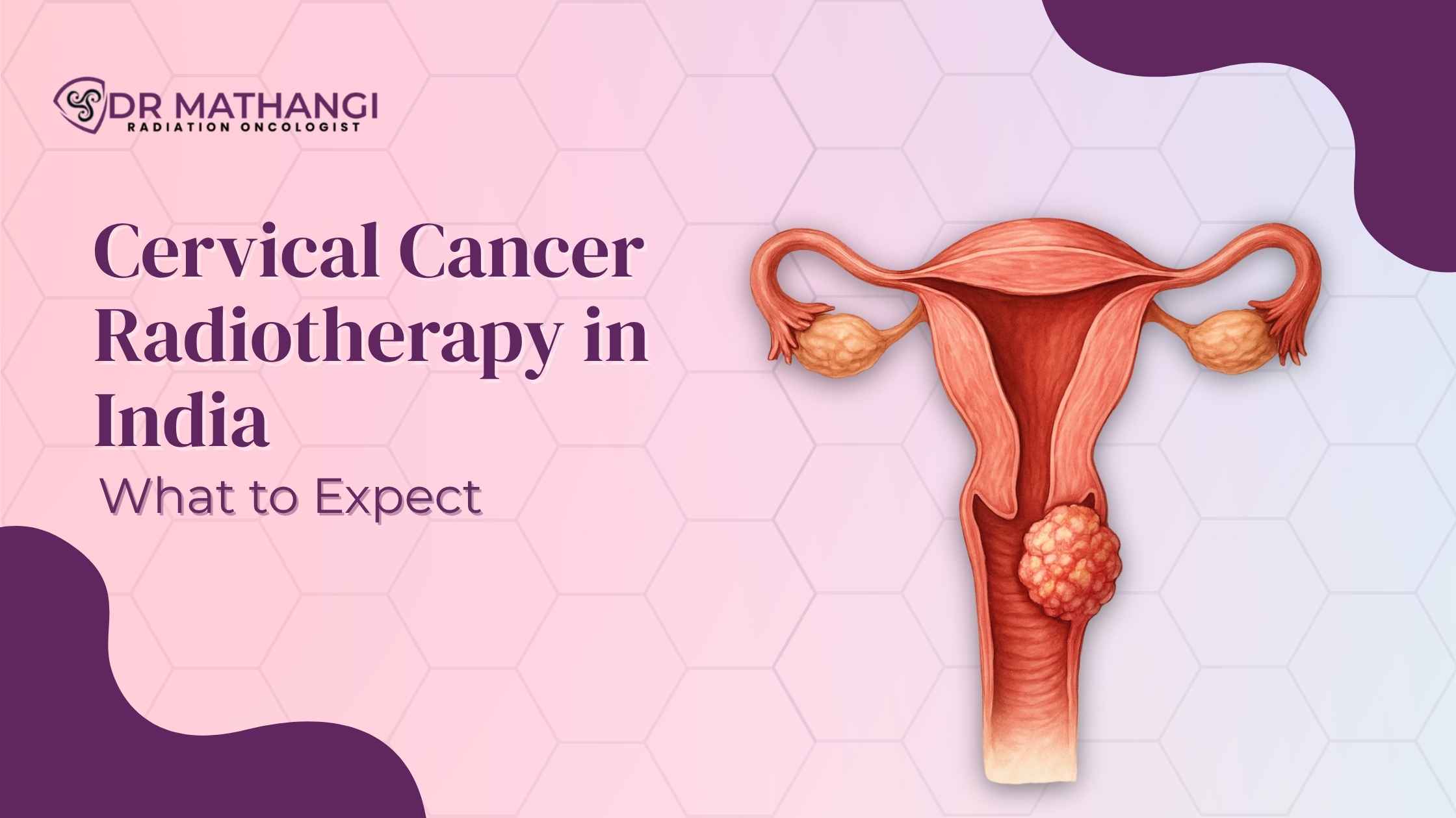 Cervical Cancer