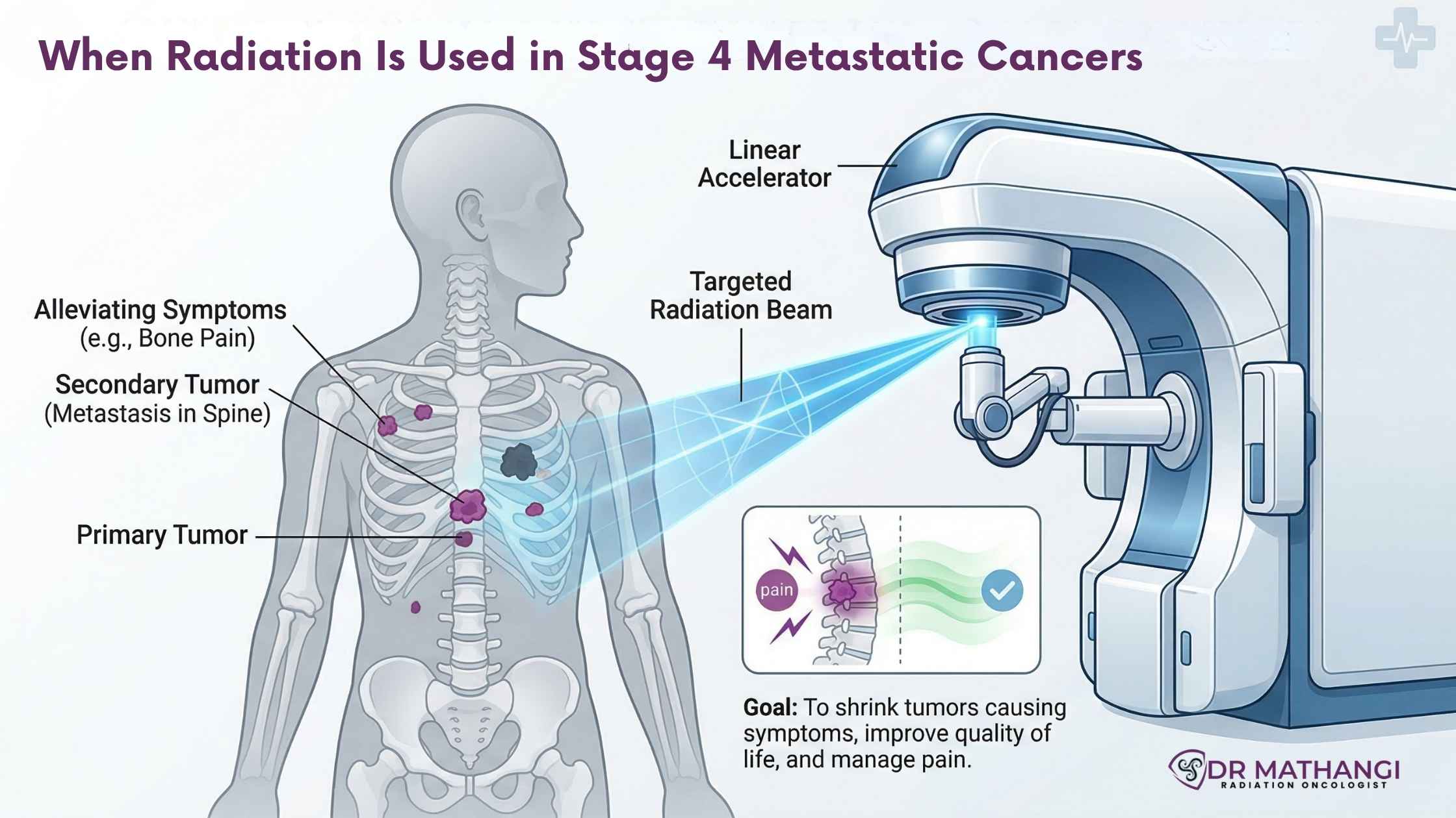 Metastatic Cancer
