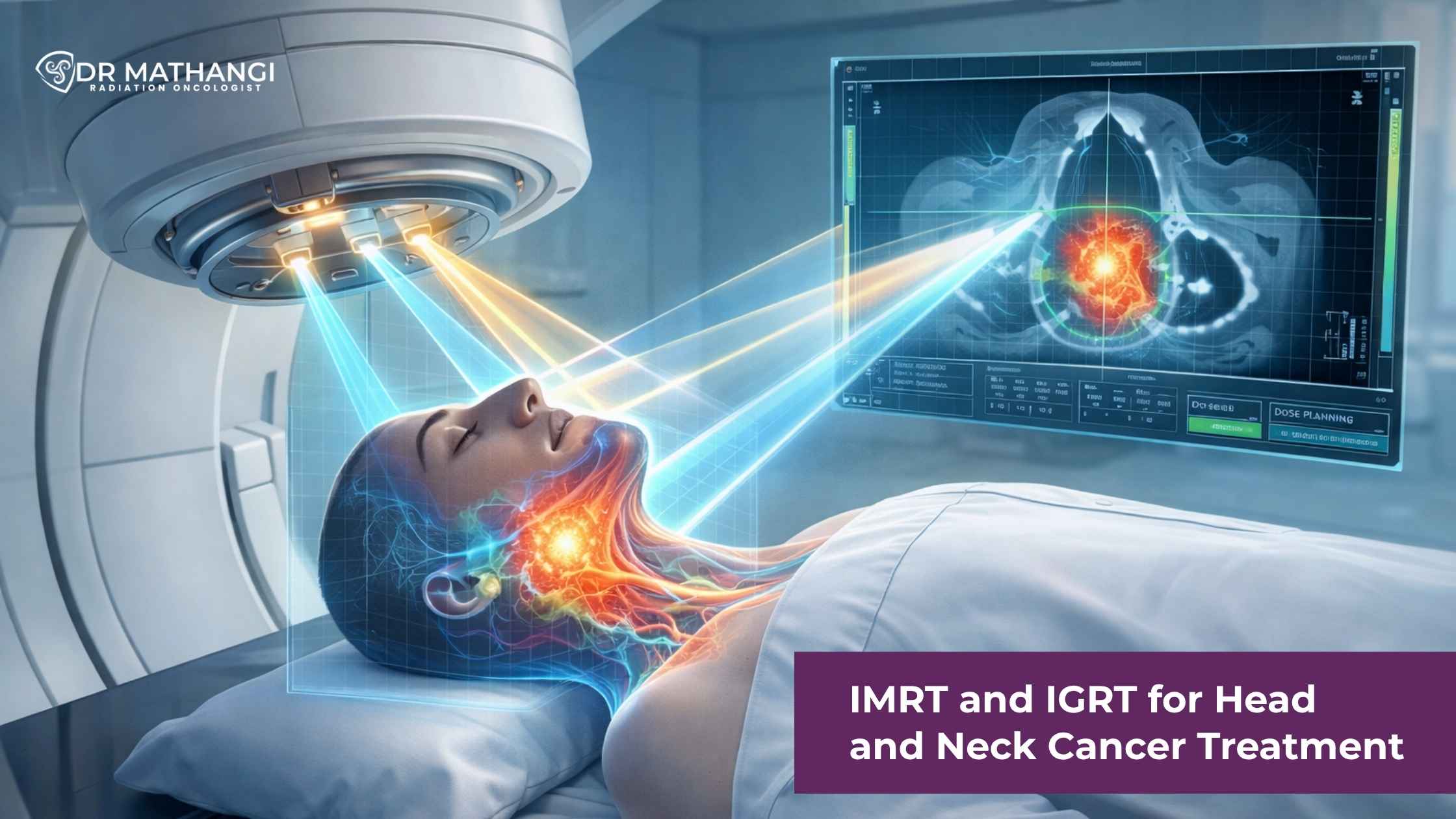 IMRT and IGRT
