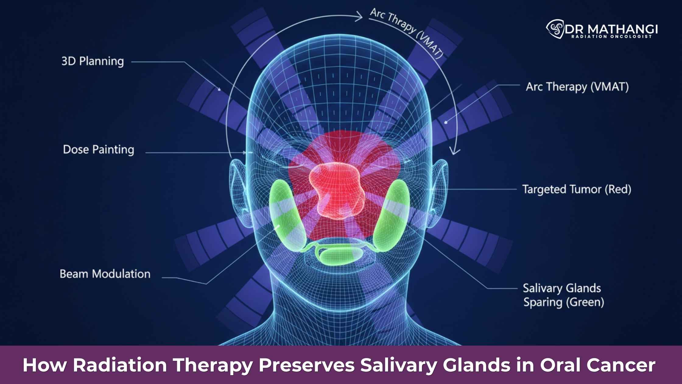 Radiation Therapy