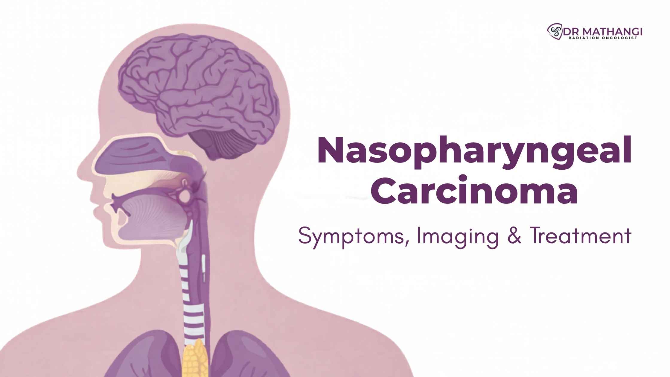 Nasopharyngeal Carcinoma: Symptoms, Imaging & Treatment