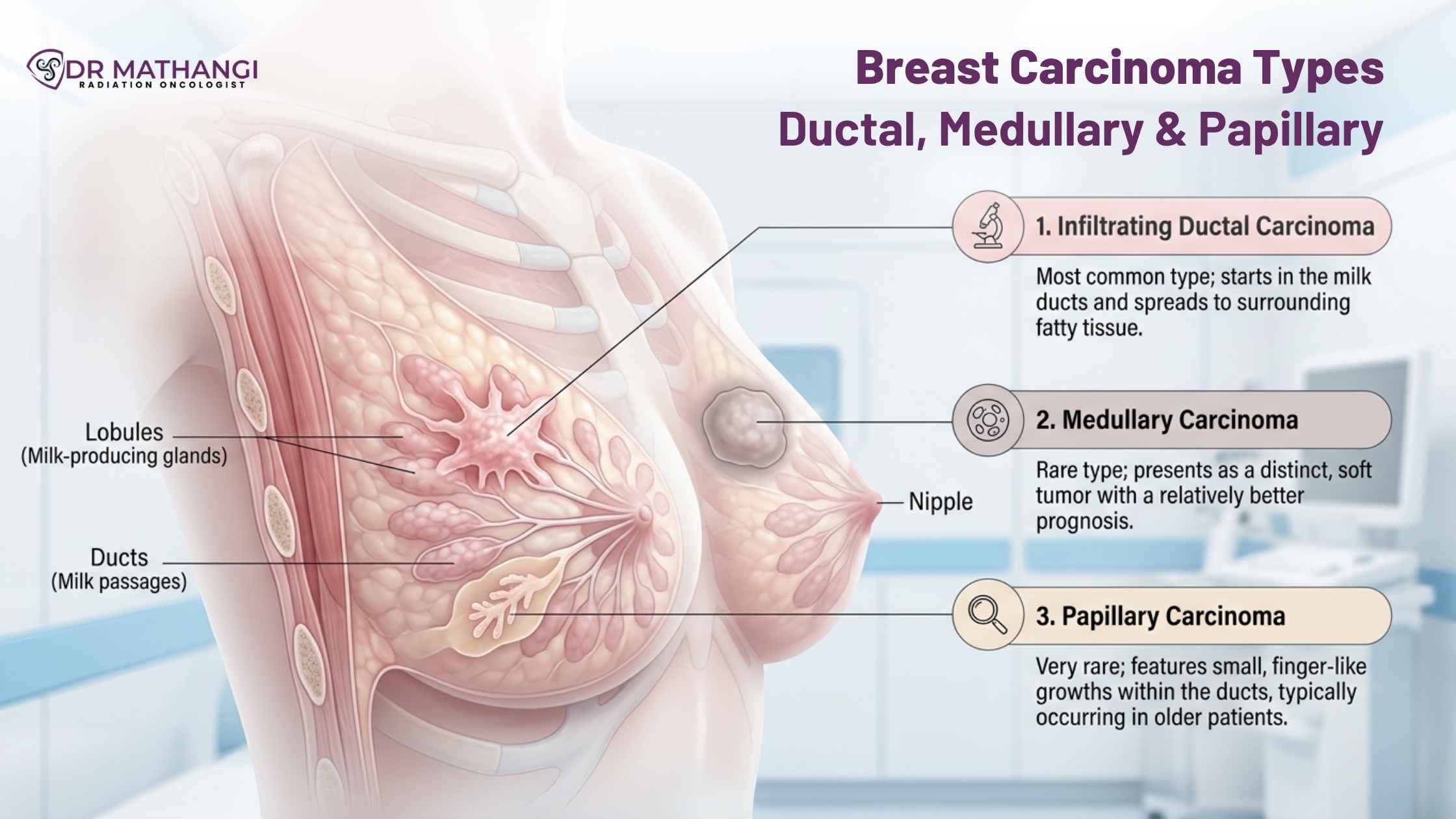Breast Carcinoma Types: Ductal, Medullary & Papillary