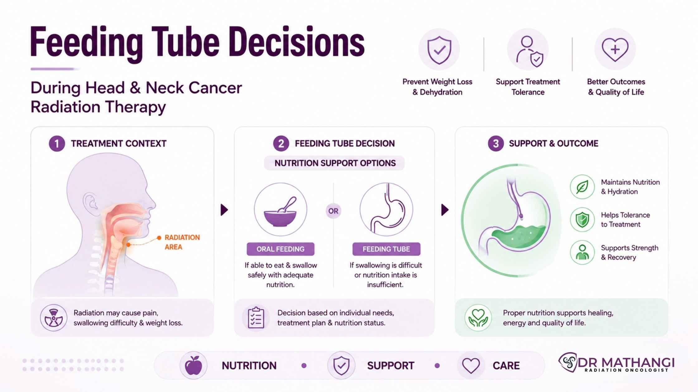 Feeding Tube Decisions During Head and Neck Cancer Radiation Therapy