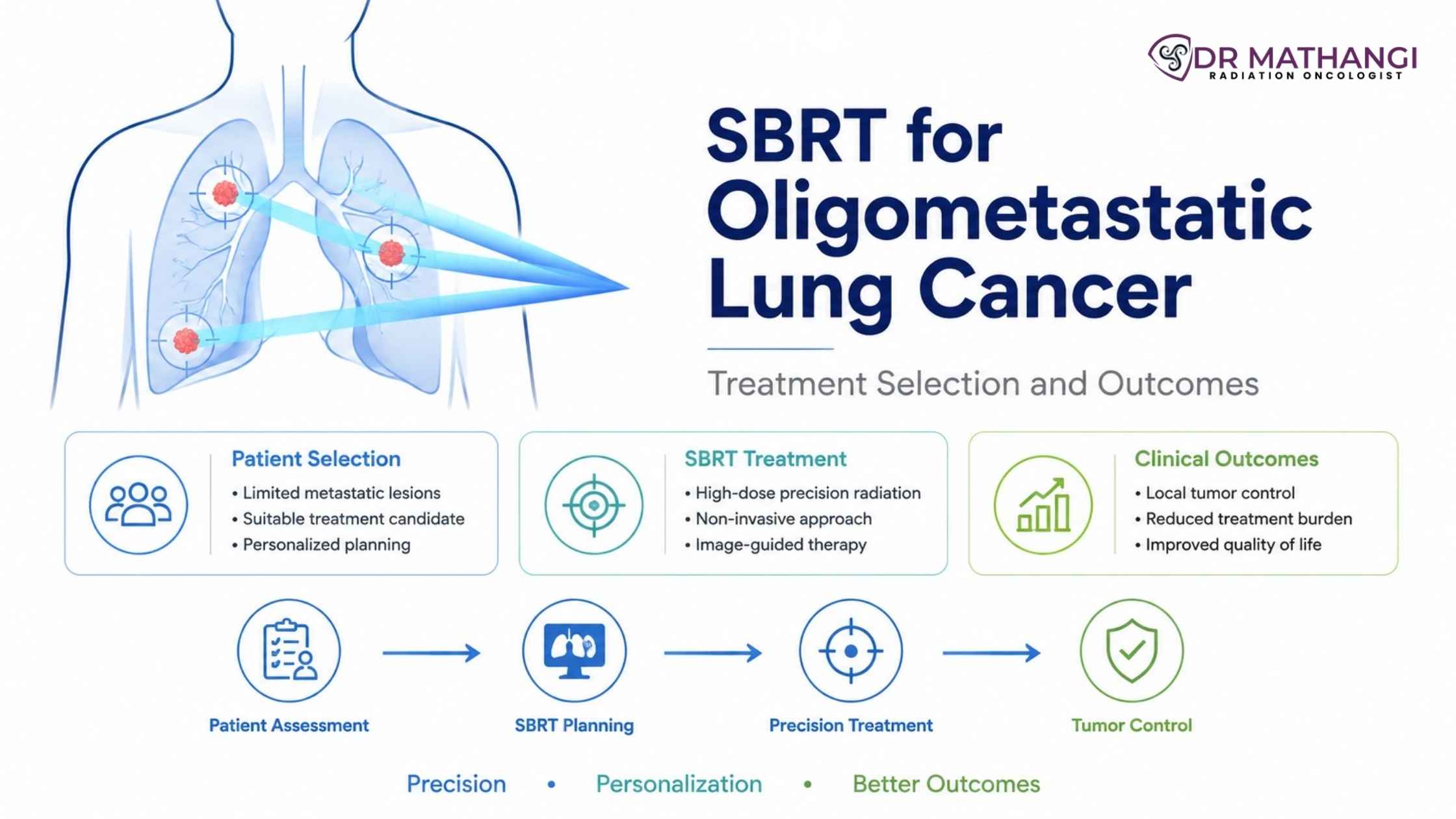 SBRT for Oligometastatic Lung Cancer: Treatment Selection and Outcomes
