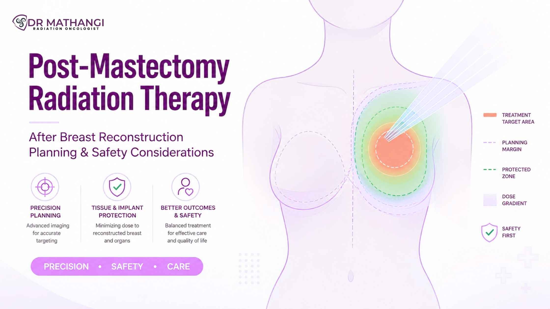 Post-Mastectomy Radiation Therapy After Breast Reconstruction: Planning and Safety Considerations