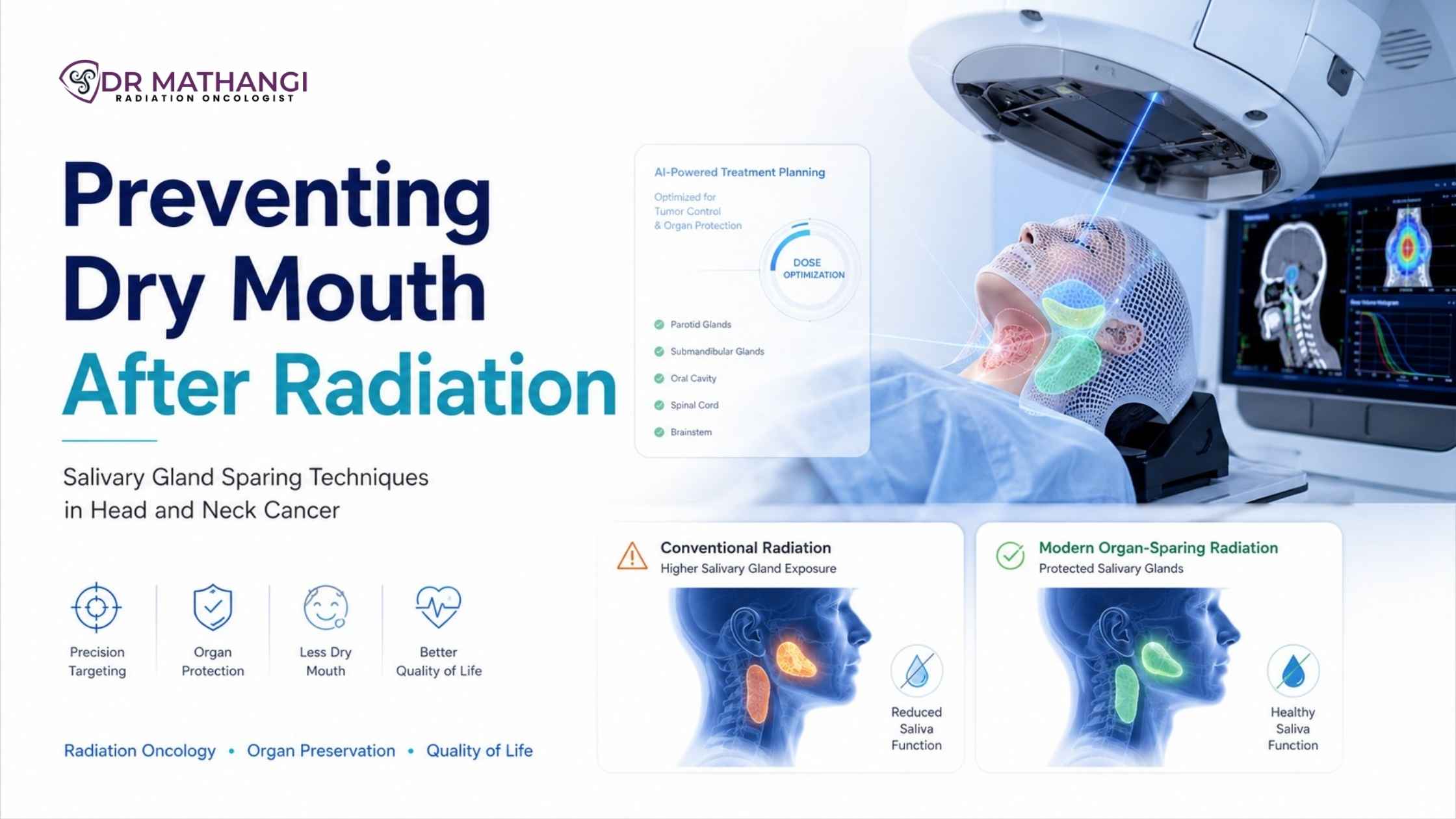 Preventing Dry Mouth After Radiation: Salivary Gland Sparing Techniques in Head and Neck Cancer