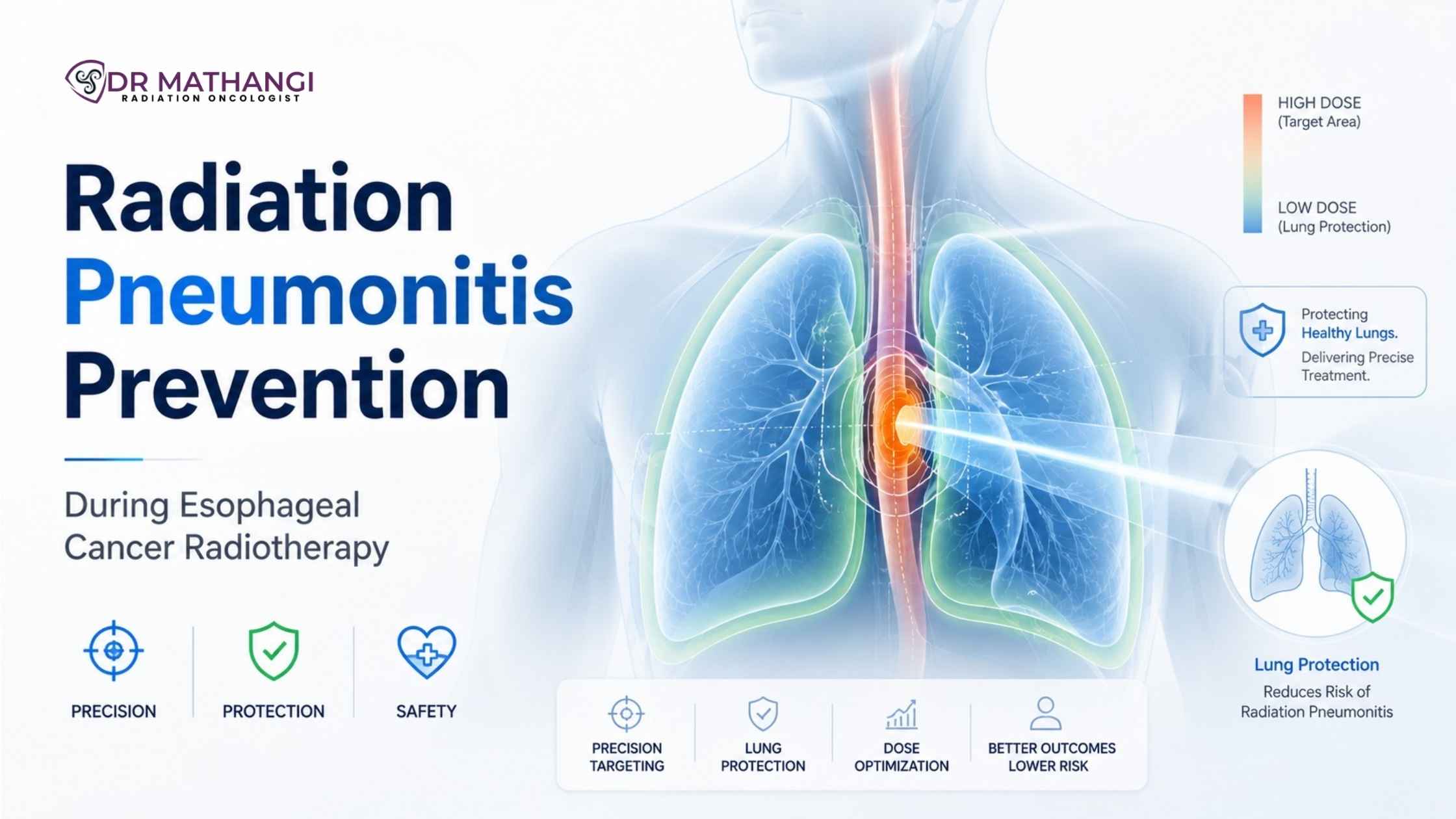 Radiation Pneumonitis Prevention During Esophageal Cancer Radiotherapy