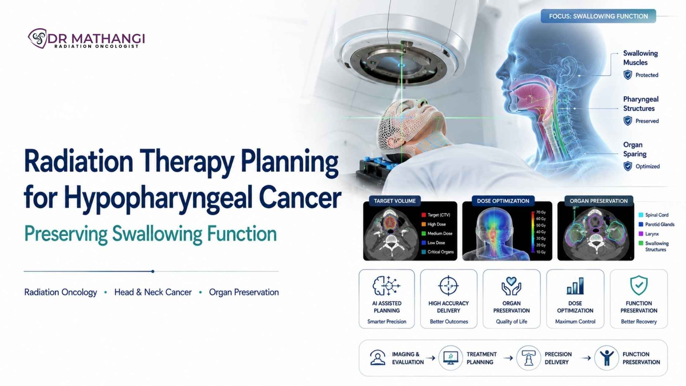Radiation Therapy Planning for Hypopharyngeal Cancer: Preserving Swallowing Function