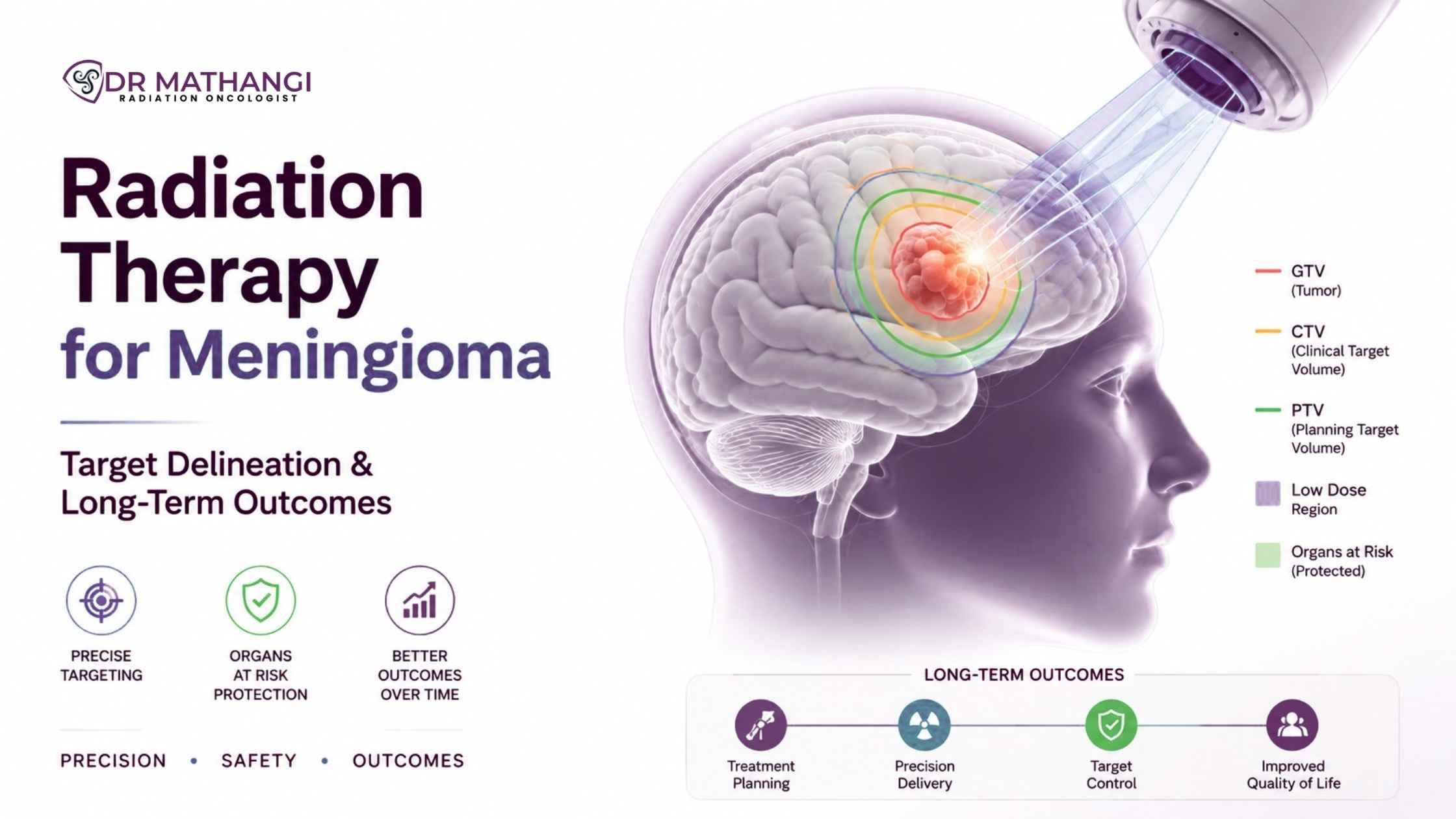 Radiation Therapy for Meningioma: Target Delineation and Long-Term Outcomes