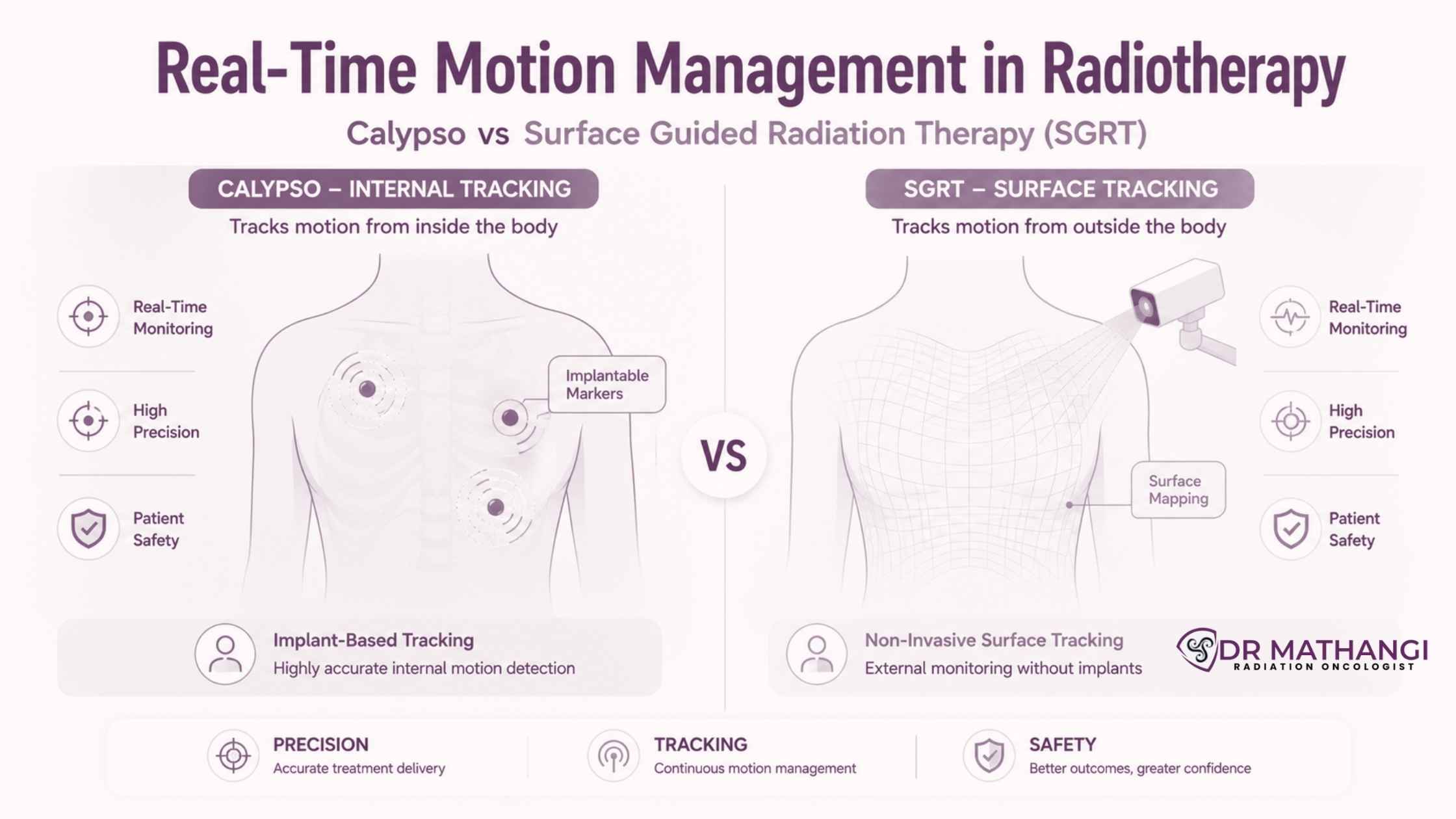 Real-Time Motion Management in Radiotherapy: Calypso vs Surface Guided Radiation Therapy (SGRT)