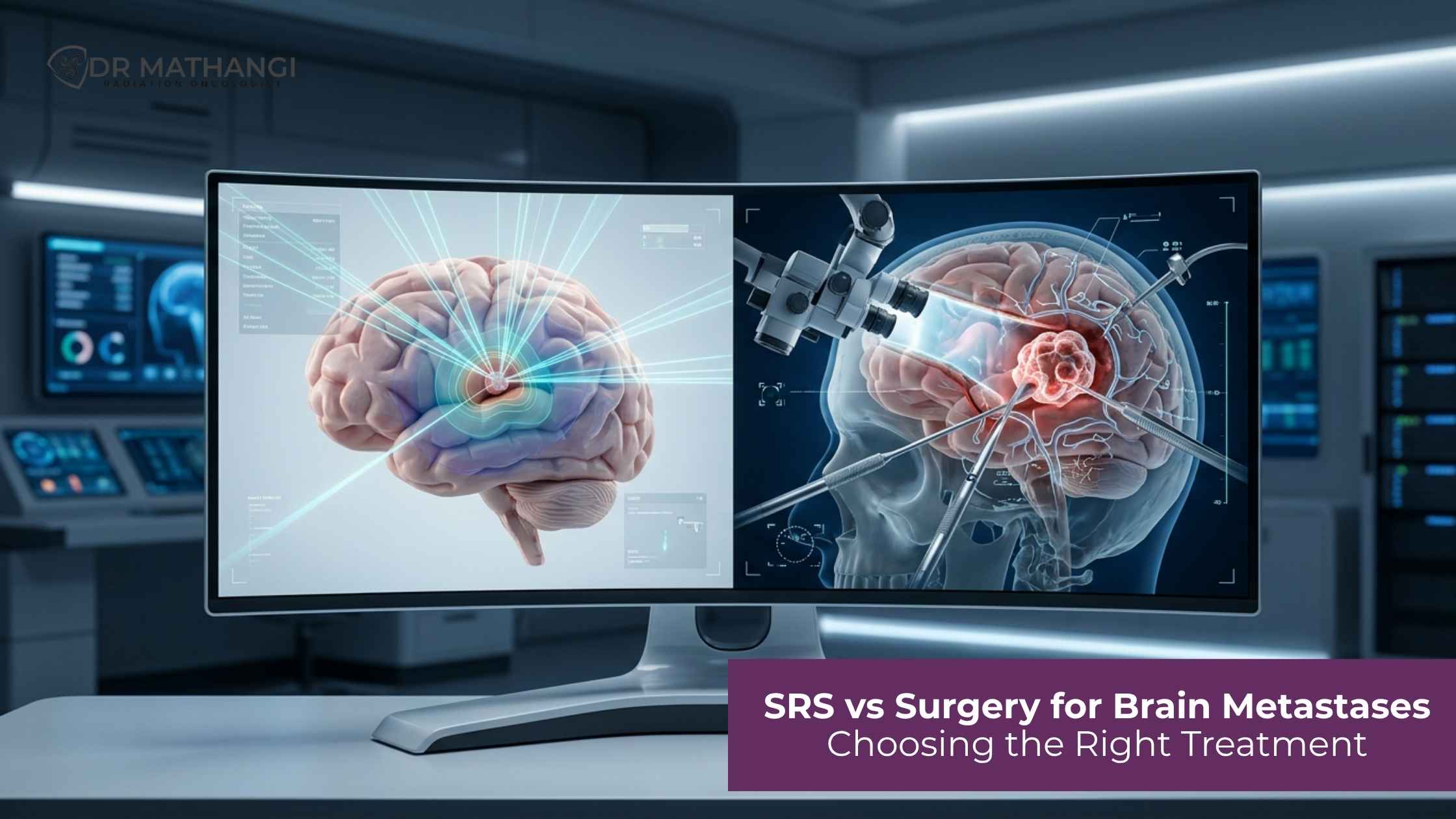SRS vs Surgery for Brain Metastases: Choosing the Right Treatment