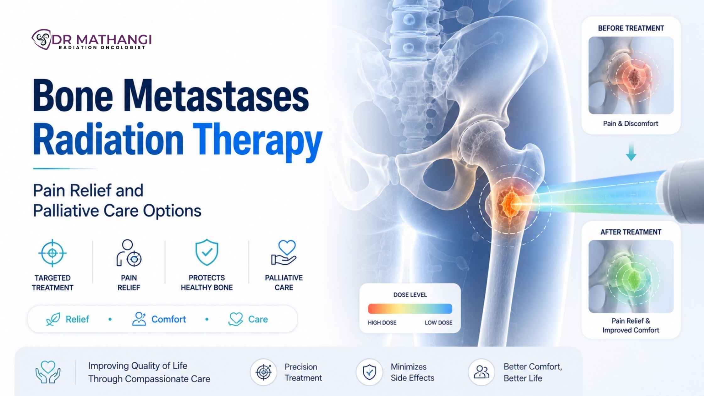 Radiation Therapy for Bone Metastases: Pain Relief and Palliative Care Options