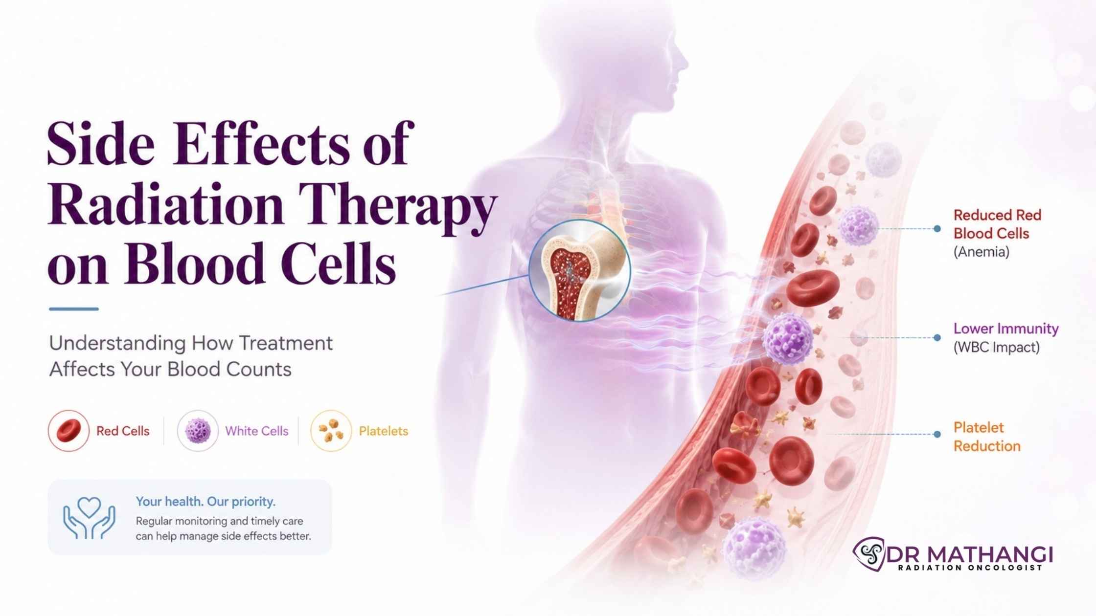 Side Effects of Radiation Therapy on Blood Cells