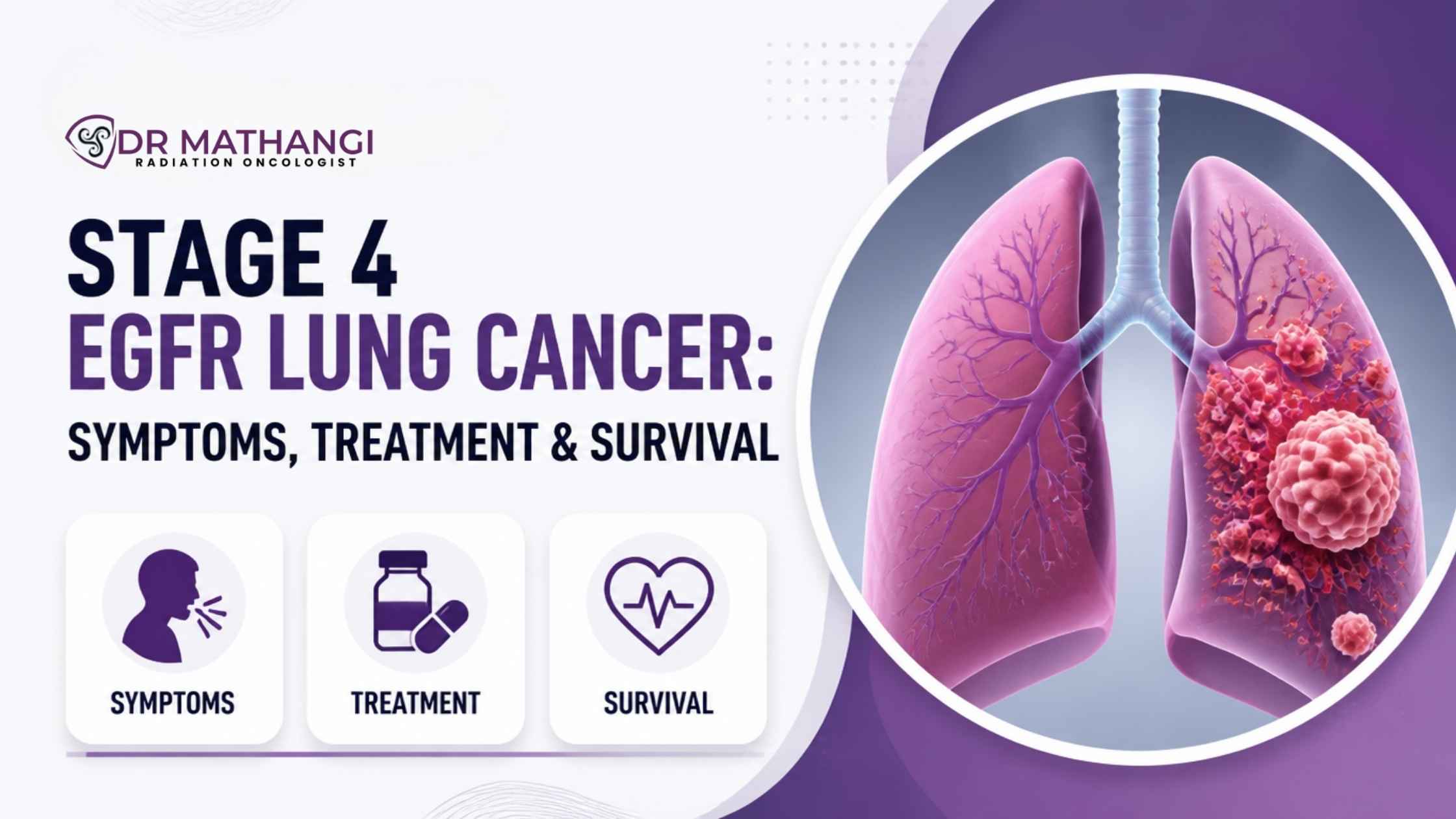 Stage 4 EGFR Lung Cancer: Symptoms, Treatment & Survival