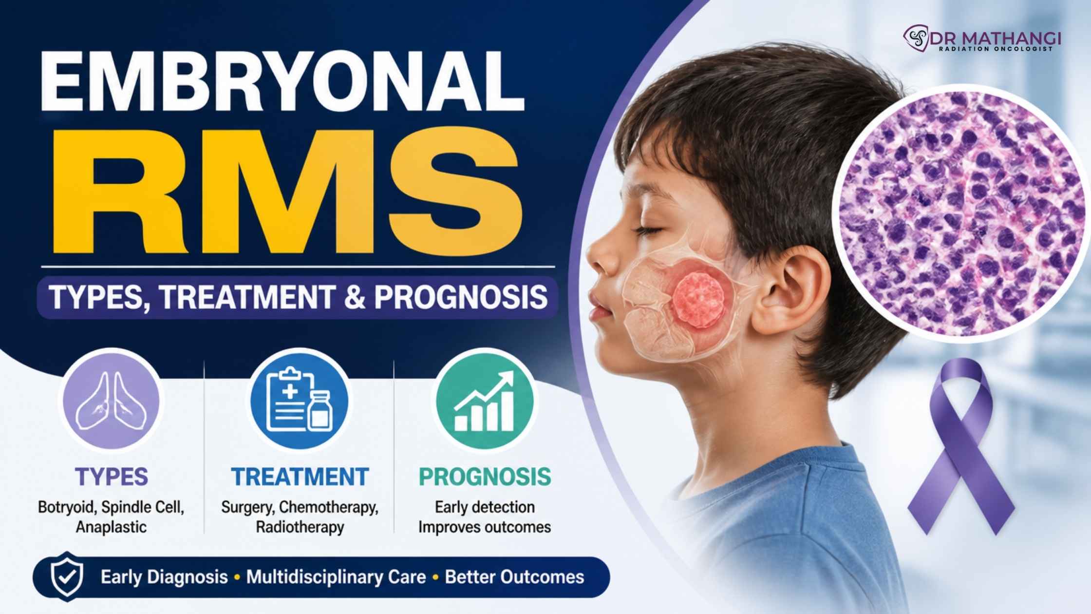 Embryonal RMS: Types, Treatment & Prognosis