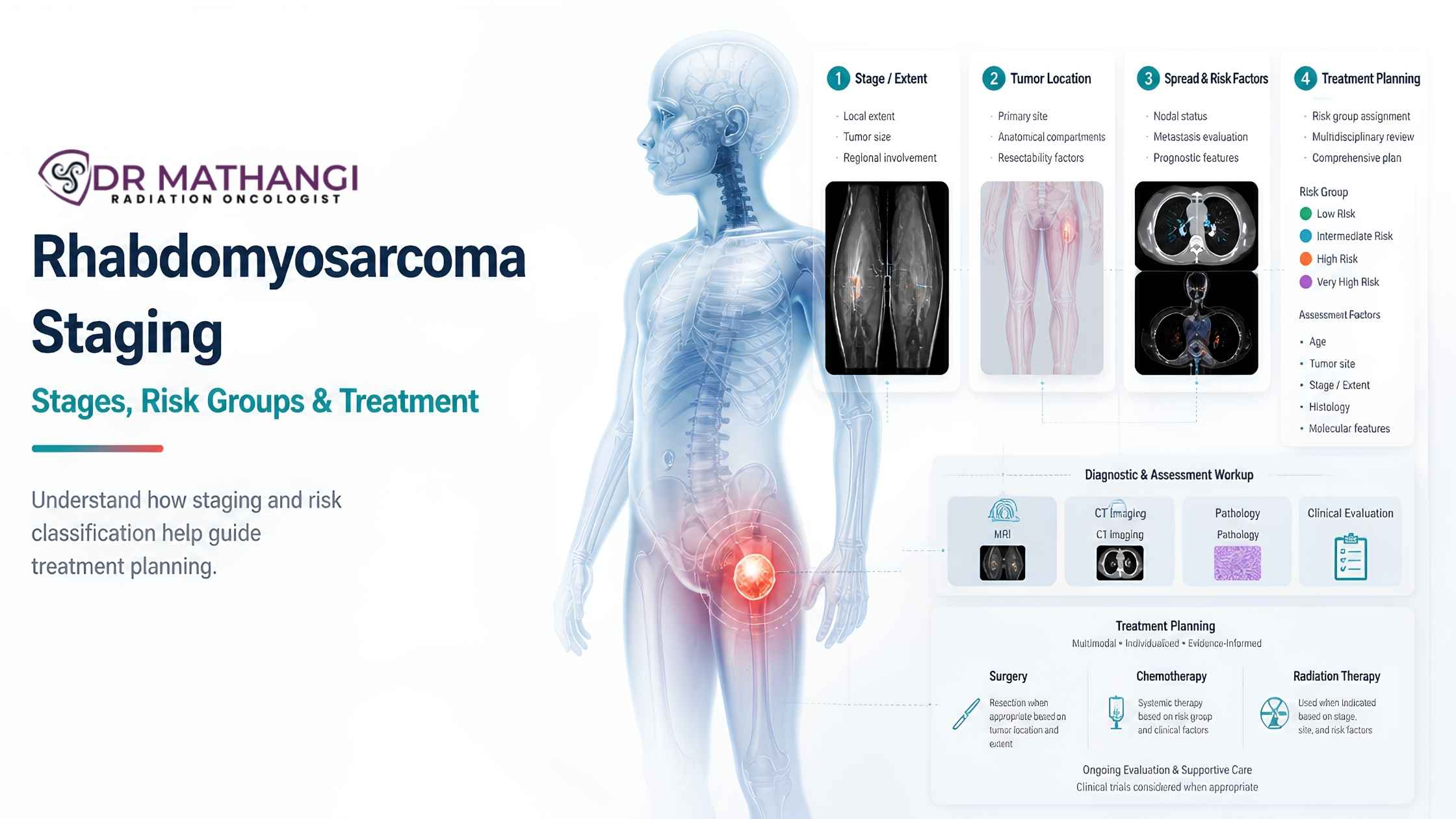 Rhabdomyosarcoma Staging: Stages, Risk Groups & Treatment