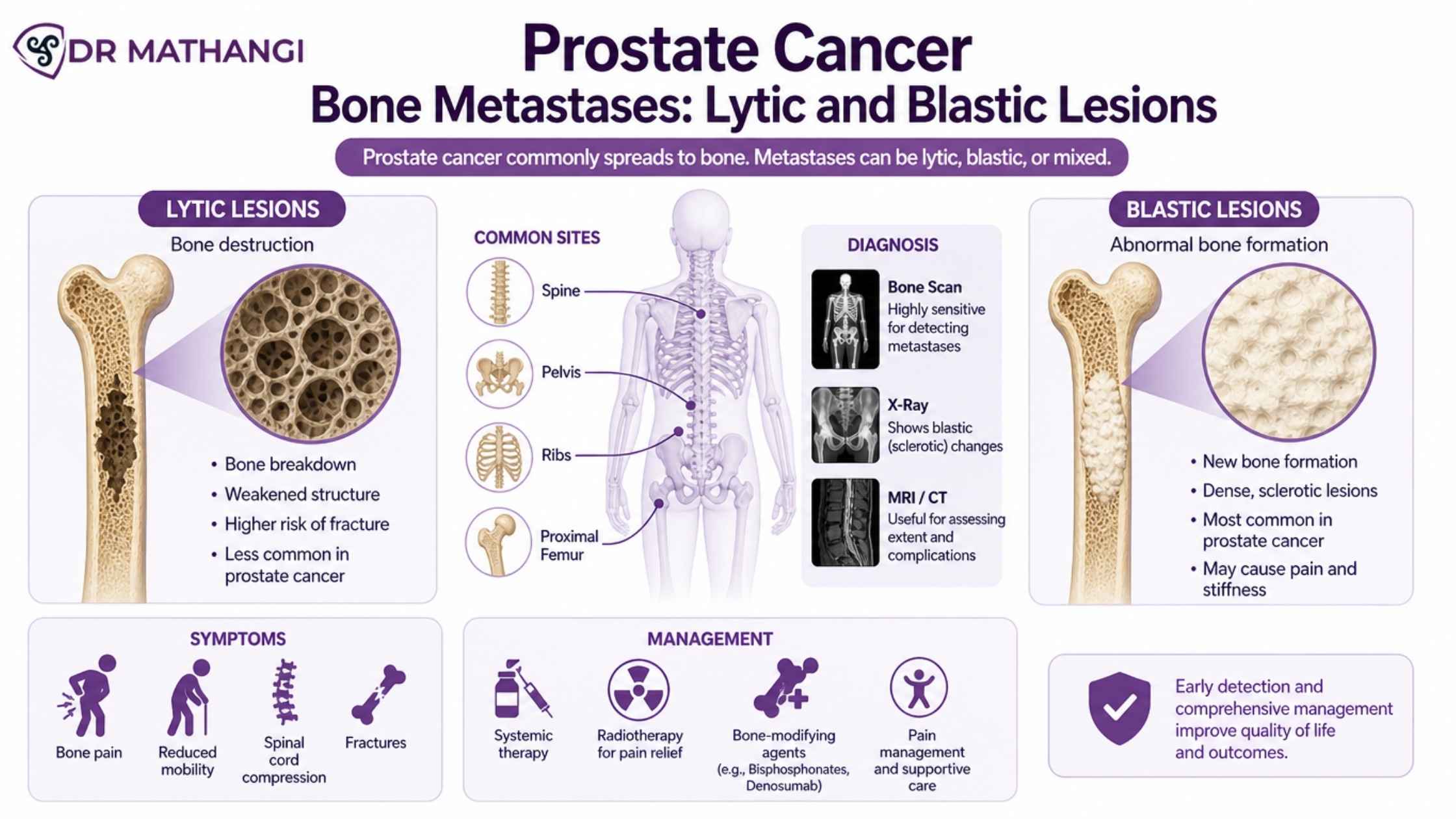 Prostate Cancer Bone Metastases: Lytic and Blastic Lesions