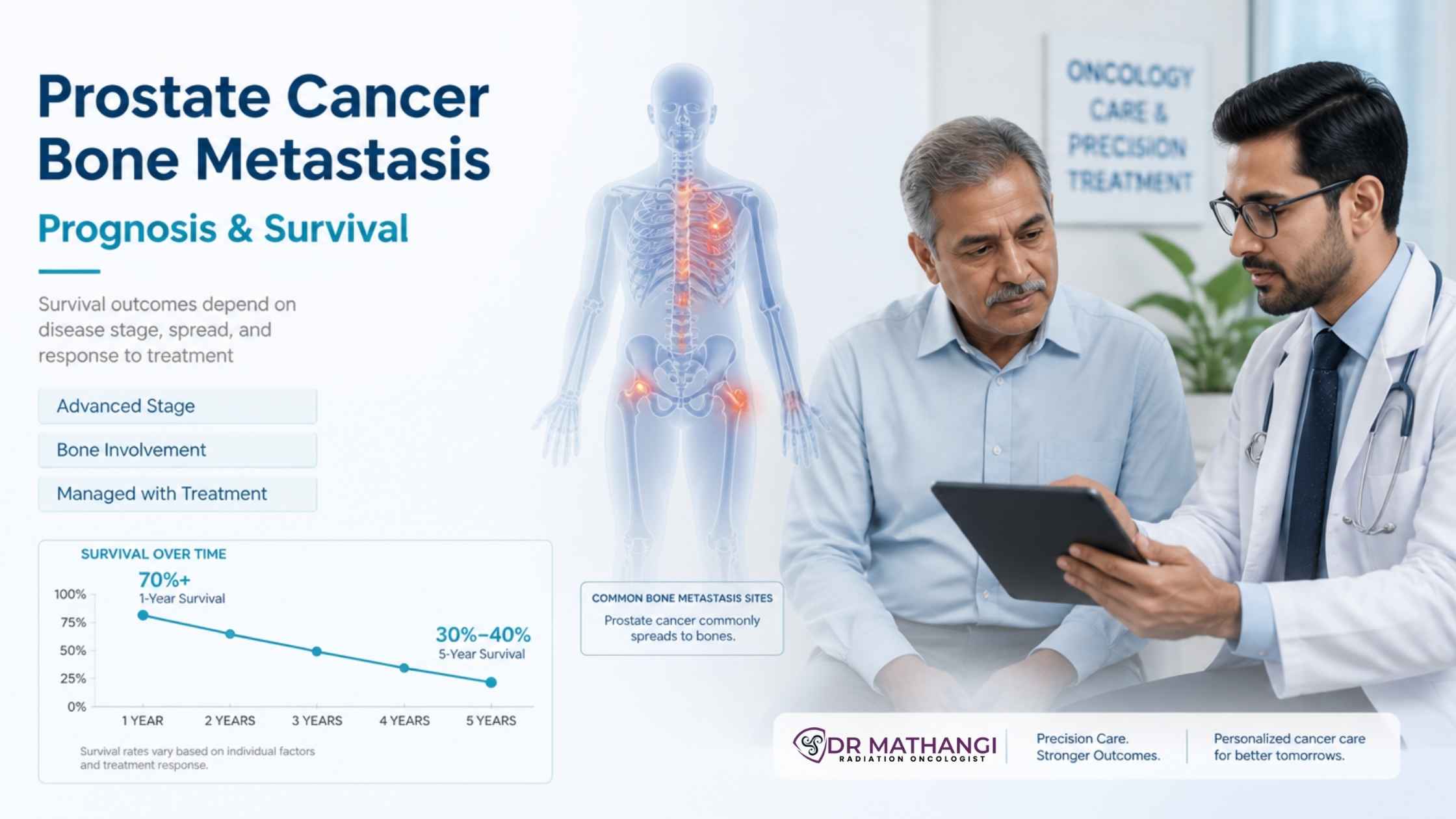 Prostate Cancer Spread to Bones: Life Expectancy