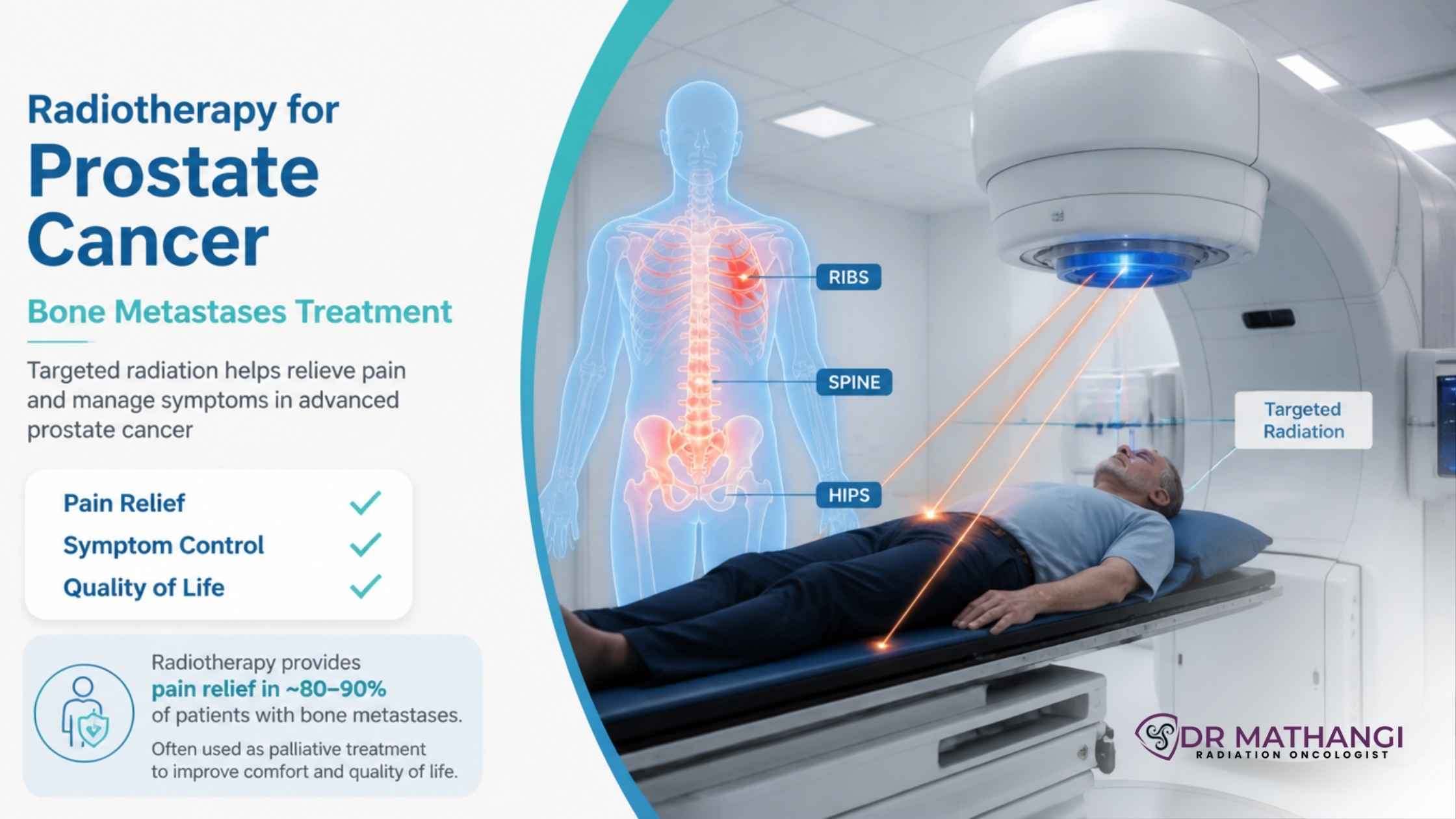 Radiotherapy for Prostate Cancer Bone Metastases