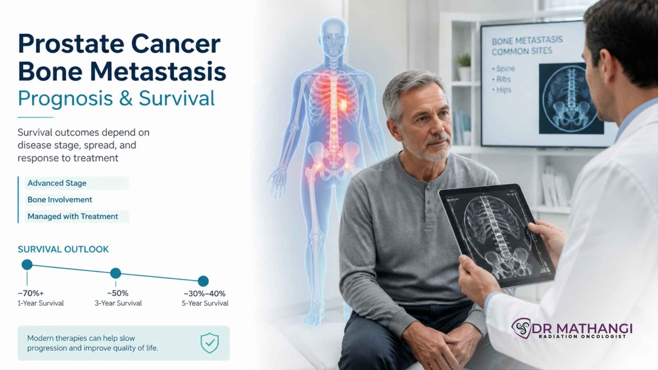 Prostate Cancer Bone Metastasis: Prognosis & Survival